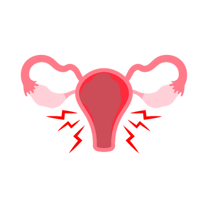 Endometrioza